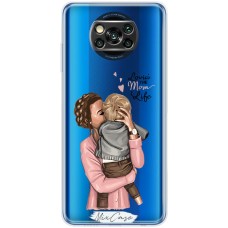 Чохол для Xiaomi Poco X3 / X3 Pro Mixcase дівчини дизайн 12