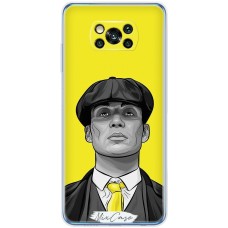 Чохол для Xiaomi Poco X3 / X3 Pro Mixcase гострі козирки дизайн 8